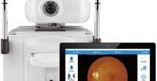 NFC600 Fully automated fundus camera